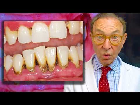 LANAP vs. Pinhole: Why You Might Need BOTH for Healthy Gums!