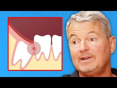 The UNTOLD TRUTH About Wisdom Teeth & Cavitations | Dr. Mark Burhenne