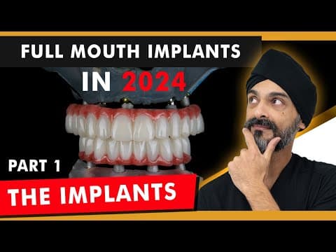 Full Mouth (all on 4) Dental Implants in 2024 - Part 1: The Implants