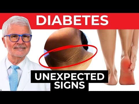 DO NOT IGNORE these Signs of Type 2 Diabetes | Dr. Gundry