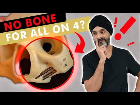 No Bone for Full Mouth Dental Implants?