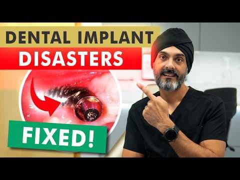 Fixed: Dental Implants Abroad