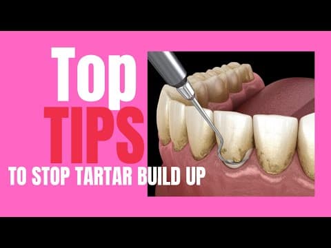 End Tartar Behind Teeth! Holistic Dentist Tips