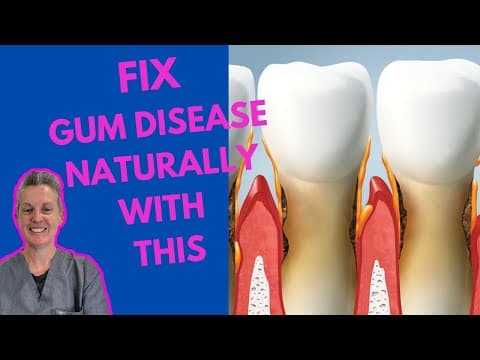 Fix Gum Disease: Eat This To Cure Gum Disease