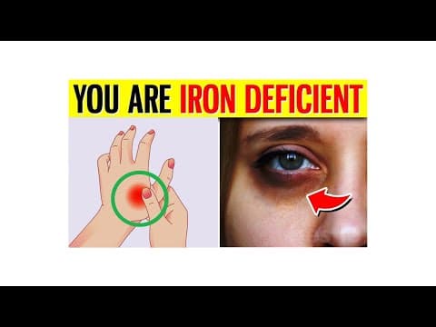 10 ALARMING Signs You Have An Iron Deficiency!
