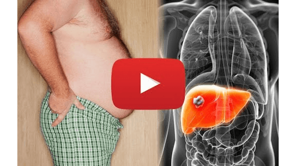 Fatty Liver GONE, Just by Doing This Once a Day