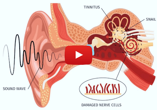 Is this noise filter causing constant ringing?